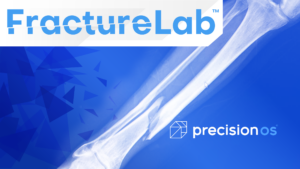 PrecisionOS FractureLab