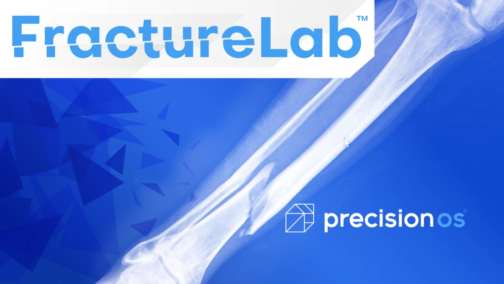 PrecisionOS FractureLab